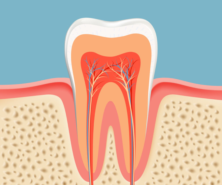 root canal treatment